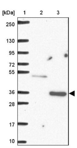 TREX2 Antibody, Novus Biologicals:Antibodies:Primary Antibodies