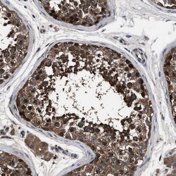 TRIAD3 Antibody, Novus Biologicals 0.1mL; Unlabeled:Antibodies, Polyclonal