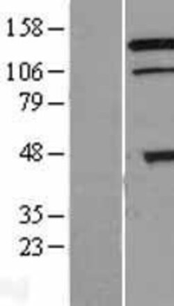 Novus Biologicals&trade;&nbsp;TRIAD3 Overexpression Lysate