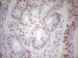 TRIB1 Antibody (OTI8C8), Novus Biologicals 0.1mL; Unlabeled:Antibodies,