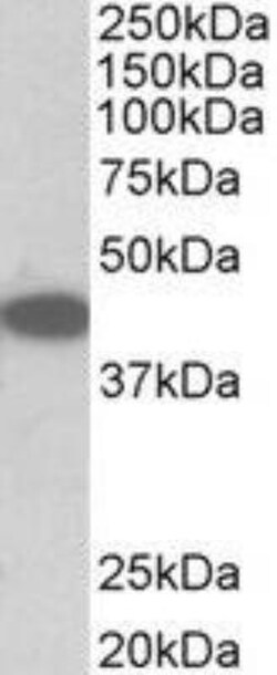 TRIB1 Antibody, Novus Biologicals 0.1mg; Unlabeled:Antibodies, Polyclonal