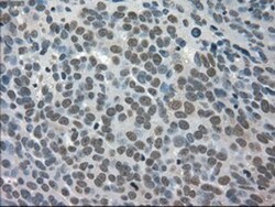 TRIB2 Antibody (OTI8D11), Novus Biologicals 0.1 mL | Buy Online | Novus Biologicals | Fisher Scientific