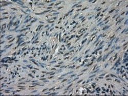 TRIB2 Antibody (OTI8D11), Novus Biologicals 0.1 mL | Buy Online | Novus Biologicals | Fisher Scientific