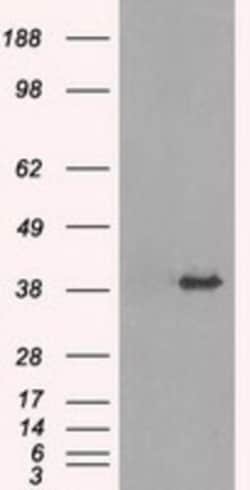 TRIB2 Antibody (OTI8D11), Novus Biologicals 0.1 mL | Buy Online | Novus Biologicals | Fisher Scientific