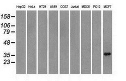 TRIB2 Antibody (OTI8D11), Novus Biologicals 0.1 mL | Buy Online | Novus Biologicals | Fisher Scientific