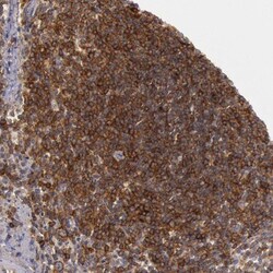 TRIB2 Antibody, Novus Biologicals:Antibodies:Primary Antibodies