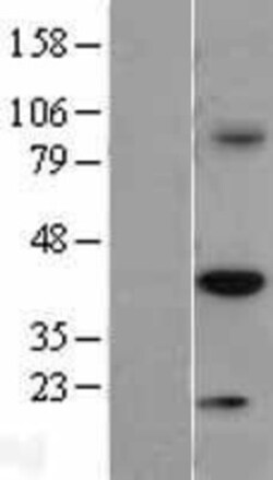 Novus Biologicals™ TRIB3 Overexpression Lysate