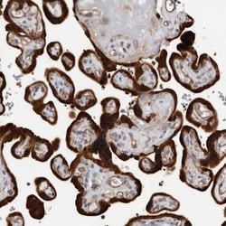 Trichohyalin Antibody, Novus Biologicals 0.1mL; Unlabeled:Antibodies, Polyclonal
