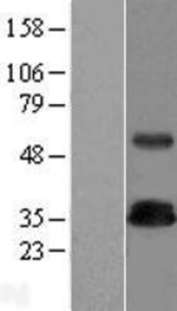 Novus Biologicals&trade;&nbsp;TRIM Overexpression Lysate