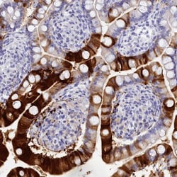 TRIM10 Antibody, Novus Biologicals:Antibodies:Primary Antibodies