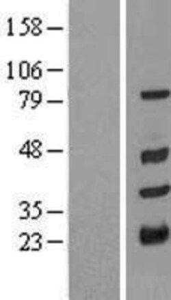 Novus Biologicals&trade;&nbsp;TRIM10 Overexpression Lysate