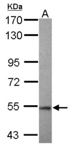 Trim11 Antibody, Novus Biologicals 0.1mL; Unlabeled:Antibodies, Polyclonal