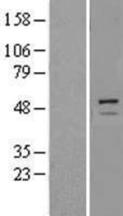 Novus Biologicals&trade;&nbsp;Trim11 Overexpression Lysate