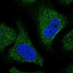 Trim11 Antibody, Novus Biologicals:Antibodies:Primary Antibodies