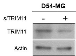 Trim11 Antibody, Novus Biologicals 0.1mg; Unlabeled:Antibodies, Polyclonal