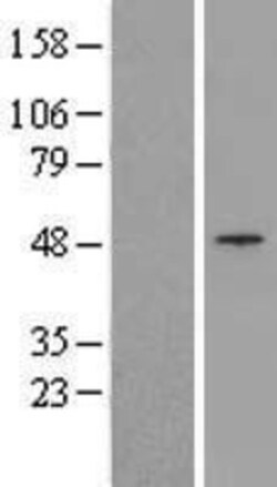 Novus Biologicals&trade;&nbsp;TRIM13 Overexpression Lysate