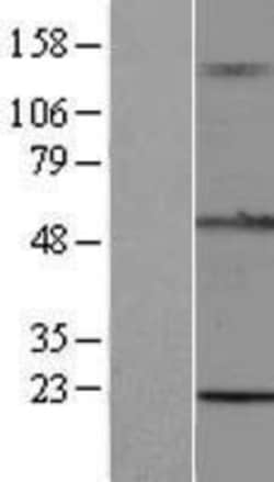 Novus Biologicals&trade;&nbsp;TRIM15 Overexpression Lysate