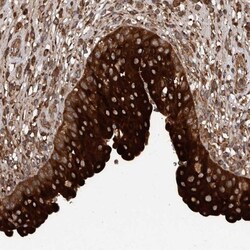 TRIM16 Antibody, Novus Biologicals 0.1mL; Unlabeled:Antibodies, Polyclonal
