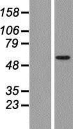 Novus Biologicals&trade;&nbsp;TRIM17 Overexpression Lysate