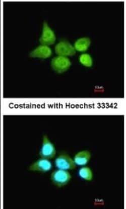 TRIM21/SSA1 Antibody, Novus Biologicals 0.1mg; Unlabeled:Antibodies, Polyclonal