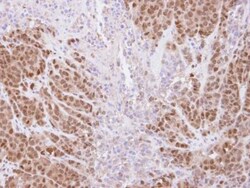 TRIM21/SSA1 Antibody, Novus Biologicals 0.1mg; Unlabeled:Antibodies, Polyclonal