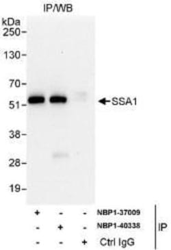 TRIM21/SSA1 Antibody, Novus Biologicals 0.1mg; Unlabeled:Antibodies, Polyclonal