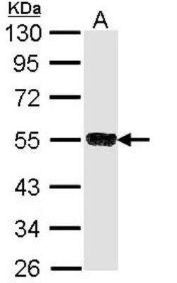 TRIM21/SSA1 Antibody, Novus Biologicals 0.1mg; Unlabeled:Antibodies, Polyclonal