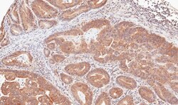 TRIM23 Antibody, Novus Biologicals 0.1mg; Unlabeled:Antibodies, Polyclonal