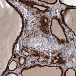TRIM23 Antibody, Novus Biologicals 0.1mL; Unlabeled:Antibodies, Polyclonal