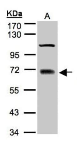 TRIM25 Antibody, Novus Biologicals 0.1mg; Unlabeled:Antibodies, Polyclonal