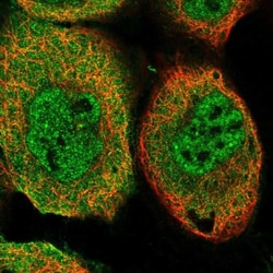TRIM26 Antibody, Novus Biologicals 0.1mL; Unlabeled:Antibodies, Polyclonal