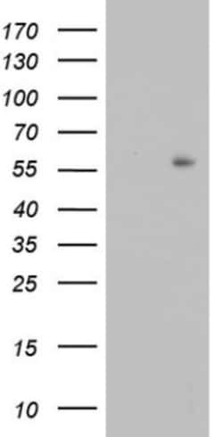 TRIM27 Antibody (OTI4D4), Novus Biologicals 0.1mL; Unlabeled:Antibodies,