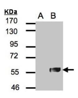 TRIM27 Antibody, Novus Biologicals 0.1mL; Unlabeled:Antibodies, Polyclonal