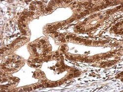 TRIM27 Antibody, Novus Biologicals 0.1mL; Unlabeled:Antibodies, Polyclonal