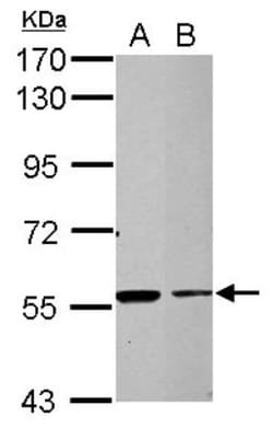 TRIM27 Antibody, Novus Biologicals 0.1mL; Unlabeled:Antibodies, Polyclonal