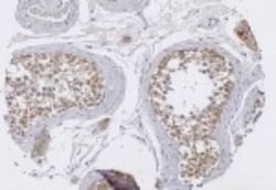 TRIM29 Antibody, Novus Biologicals:Antibodies:Primary Antibodies