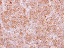 TRIM29 Antibody, Novus Biologicals 0.1mL; Unlabeled:Antibodies, Polyclonal