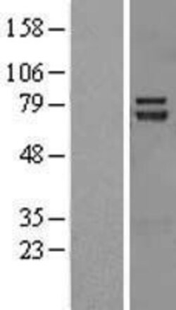 Novus Biologicals™ TRIM32 Overexpression Lysate
