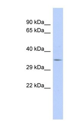 TRIM34 Antibody, Novus Biologicals:Antibodies:Primary Antibodies