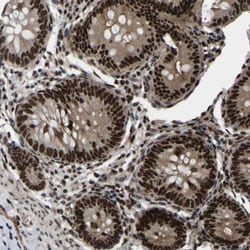TRIM35 Antibody, Novus Biologicals:Antibodies:Primary Antibodies