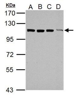 TRIM37 Antibody, Novus Biologicals 0.1 mL | Buy Online | Novus Biologicals | Fisher Scientific