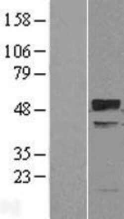Novus Biologicals&trade;&nbsp;TRIM38 Overexpression Lysate