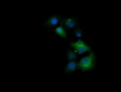 TRIM38 Antibody (OTI113D3), Novus Biologicals 0.1mL; Unlabeled:Antibodies,