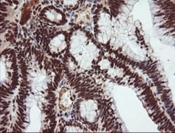 TRIM38 Antibody (OTI113D3), Novus Biologicals 0.1mL; Unlabeled:Antibodies,
