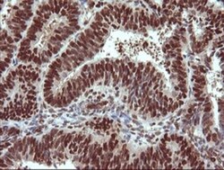 TRIM38 Antibody (OTI113D3), Novus Biologicals 0.1mL; Unlabeled:Antibodies,