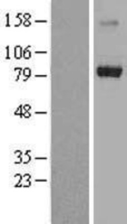 Novus Biologicals&trade;&nbsp;TRIM3/BERP Overexpression Lysate