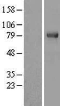 Novus Biologicals&trade;&nbsp;TRIM3/BERP Overexpression Lysate