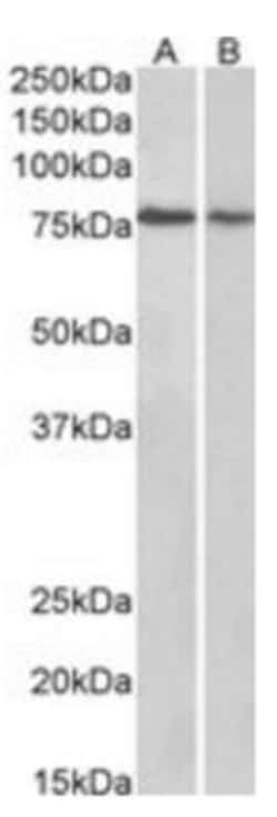 TRIM3/BERP Antibody, Novus Biologicals 0.1mg; Unlabeled:Antibodies, Polyclonal
