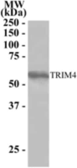 TRIM4 Antibody, Novus Biologicals 0.1mg; Unlabeled:Antibodies, Polyclonal