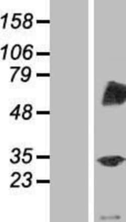 Novus Biologicals&trade;&nbsp;TRIM4 Overexpression Lysate